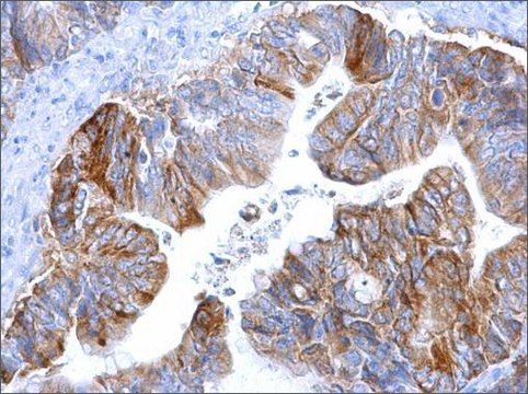 Monoclonal Anti-MCT1 antibody produced in