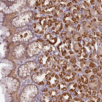 Anti-STK35 antibody produced in rabbit