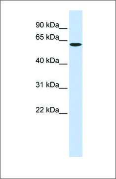 Anti-SPTLC1 antibody produced in rabbit