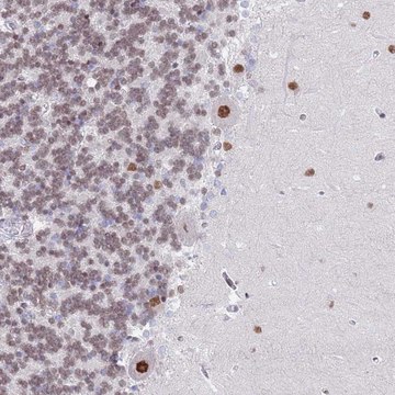Anti-ZNF382 antibody produced in rabbit