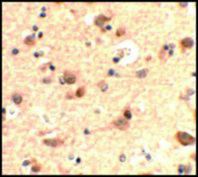 Anti-RUSC2 antibody produced in rabbit