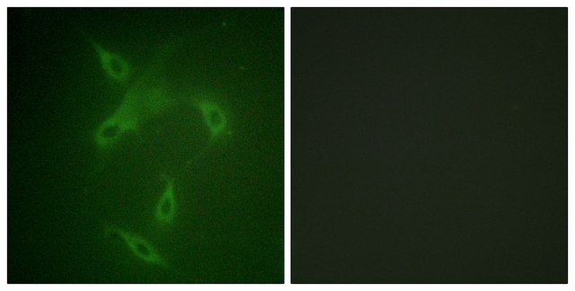 Anti-JAK2 antibody produced in rabbit