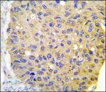 Anti-GHRH (center) antibody produced in