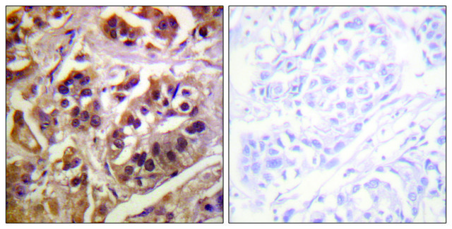 Anti-IKK-? antibody produced in rabbit