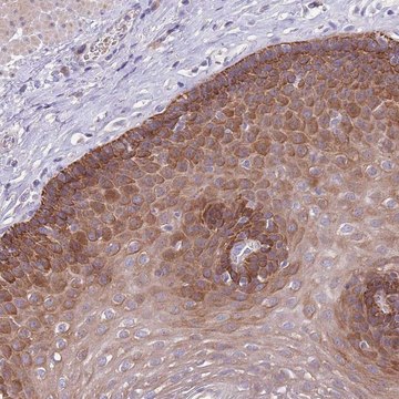 Anti-ZNF658 antibody produced in rabbit