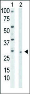 Anti-TK2 (N-term) antibody produced in