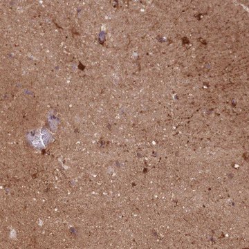 Anti-DPYSL4 antibody produced in rabbit