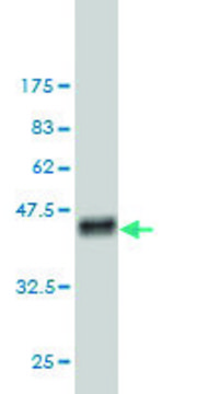 ANTI-FHIT antibody produced in mouse