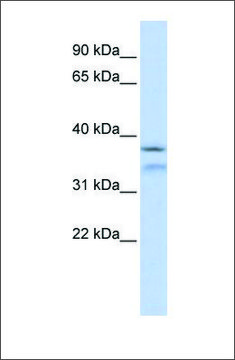 Anti-HYLS1 antibody produced in rabbit