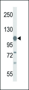 ANTI-GLDC (N-TERM) antibody produced in