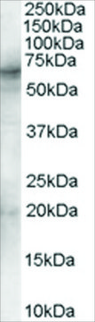Anti-Spleen tyrosine kinase/SYK antibody produced