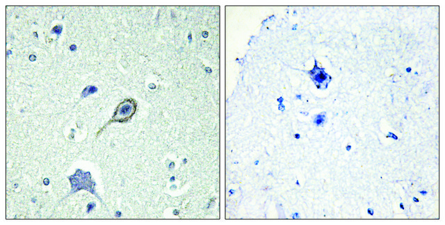 Anti-CNR1 antibody produced in rabbit
