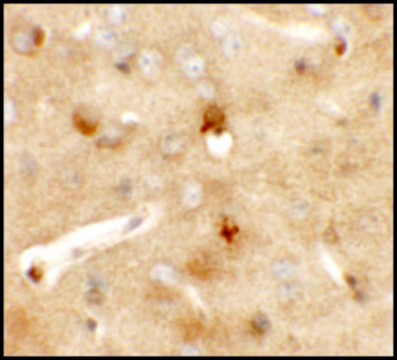 Anti-CCDC141 antibody produced in rabbit