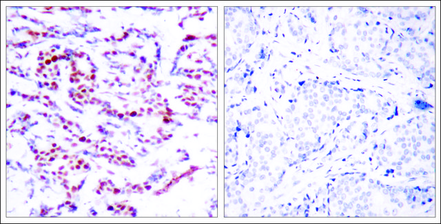 Anti-phospho-ATF2 (pSer¹¹² or pSer??) antibody