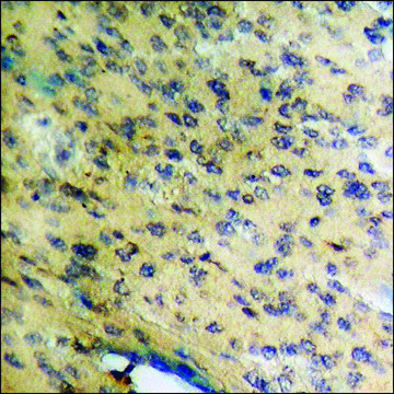 Anti-phospho-C-RAF (pSer²??) antibody produced in