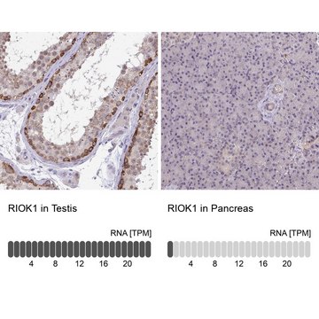 Anti-RIOK1 antibody produced in rabbit