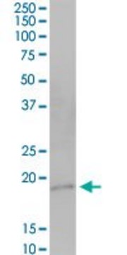 Anti-HSPC159 antibody produced in mouse