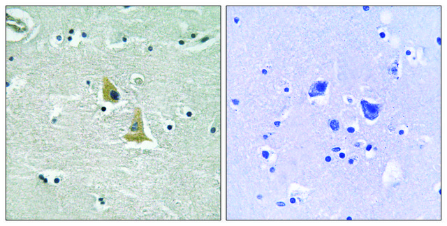 Anti-p47 PHOX, C-Terminal antibody produced