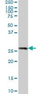 Anti-PROSC antibody produced in mouse