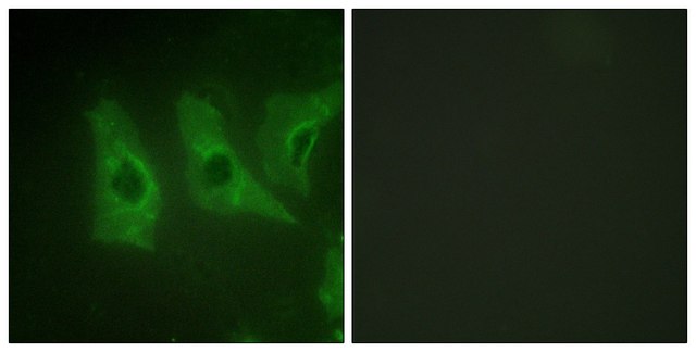 Anti-CKI-? antibody produced in rabbit