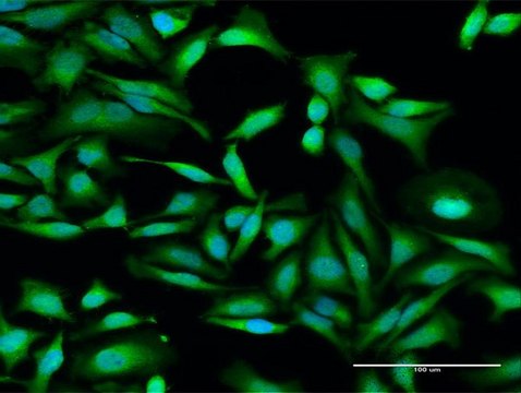 Anti-IFIT2 antibody produced in rabbit