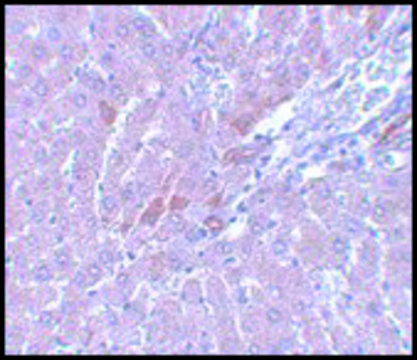 Anti-LYRM1 antibody produced in rabbit