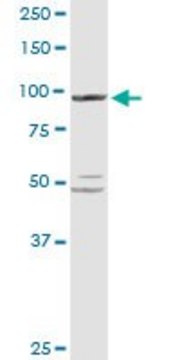 Anti-PYGL antibody produced in rabbit
