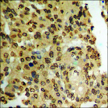 Anti-phospho-PDK1 (pSer²?¹) antibody produced in