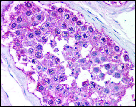 Anti-NR0B1 (AB2) antibody produced in