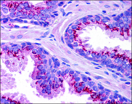 Anti-SLC37A2 antibody produced in rabbit