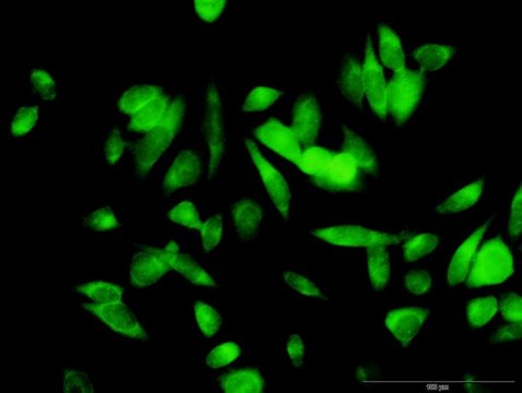 Anti-ME1 antibody produced in rabbit