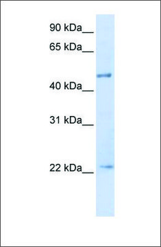 Anti-TRIM21 antibody produced in rabbit