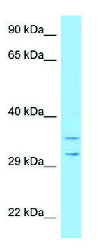 Anti-RPS2 antibody produced in rabbit