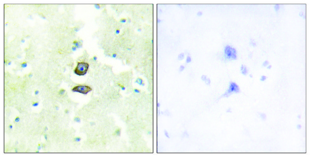 Anti-BRI3B antibody produced in rabbit