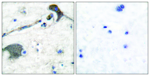 Anti-RASH antibody produced in rabbit