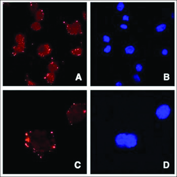 Anti-ASPORIN/ASPN antibody produced in goat
