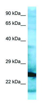 Anti-RPL15 (N-terminal) antibody produced in
