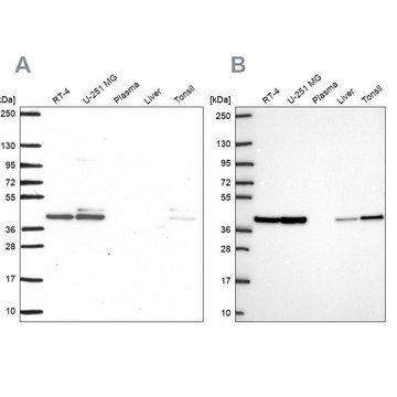 Anti-STRAP antibody produced in rabbit
