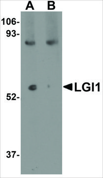 Anti-LGI1 (ab2) antibody produced in