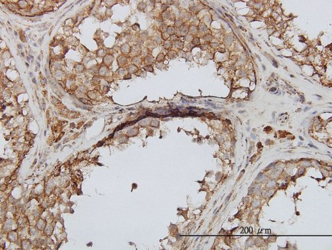Monoclonal Anti-PIP5K3 antibody produced in