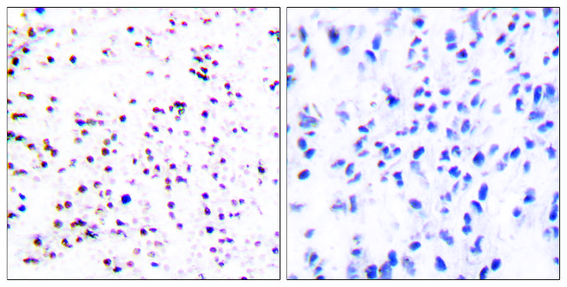 Anti-MCM5 antibody produced in rabbit