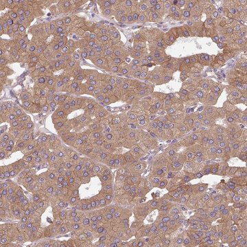 Anti-FAT4 antibody produced in rabbit