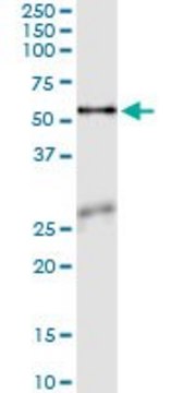 Monoclonal Anti-ASNS antibody produced in