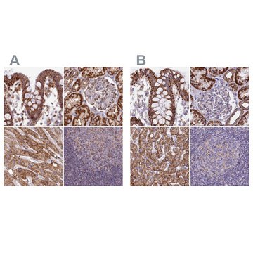 Anti-HSDL2 antibody produced in rabbit