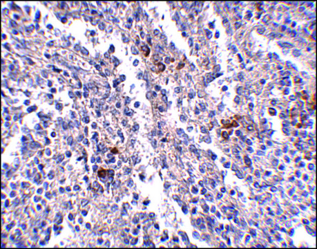 Anti-SYPL2 antibody produced in rabbit