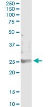 Monoclonal Anti-TEB1 antibody produced in