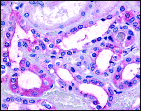 Anti-TAAR9/TA3 antibody produced in rabbit