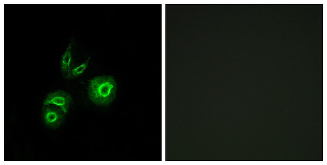 Anti-MET antibody produced in rabbit