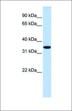 Anti-MARCH1 antibody produced in rabbit