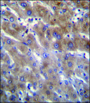 ANTI-ANKRD18B (N-TERM) antibody produced in